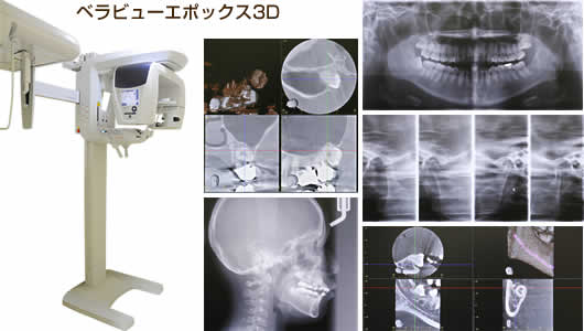 ベラビューエポックス3D、CT撮影からパノラマ撮影、セファロ撮影まで